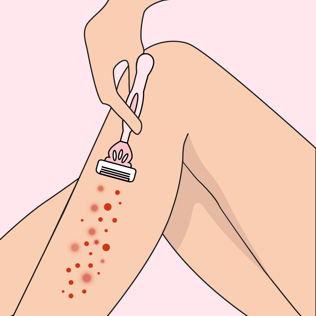 Razor Bump Prevention Secrets: How to Shave Smoothly Without Skin ...